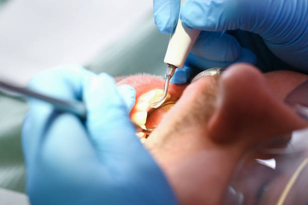 Best Weekend Emergency Dentist in Newton, NC